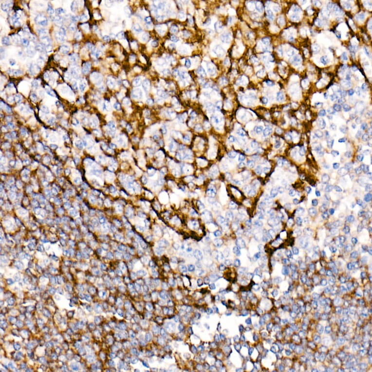 Immunohistochemistry - Anti-CD35 Antibody [ARC2065] (A305576) - Antibodies.com