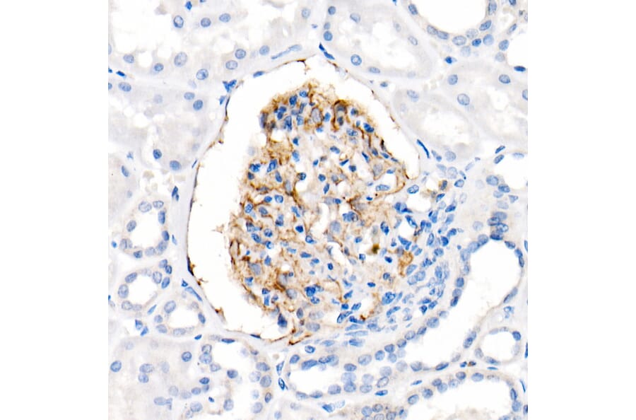 Immunohistochemistry - Anti-CD35 Antibody [ARC2065] (A305576) - Antibodies.com