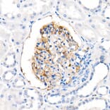 Immunohistochemistry - Anti-CD35 Antibody [ARC2065] (A305576) - Antibodies.com