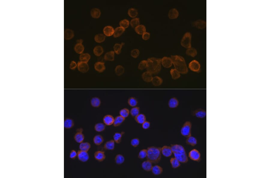 Immunofluorescence - Anti-CD35 Antibody [ARC2065] (A305576) - Antibodies.com