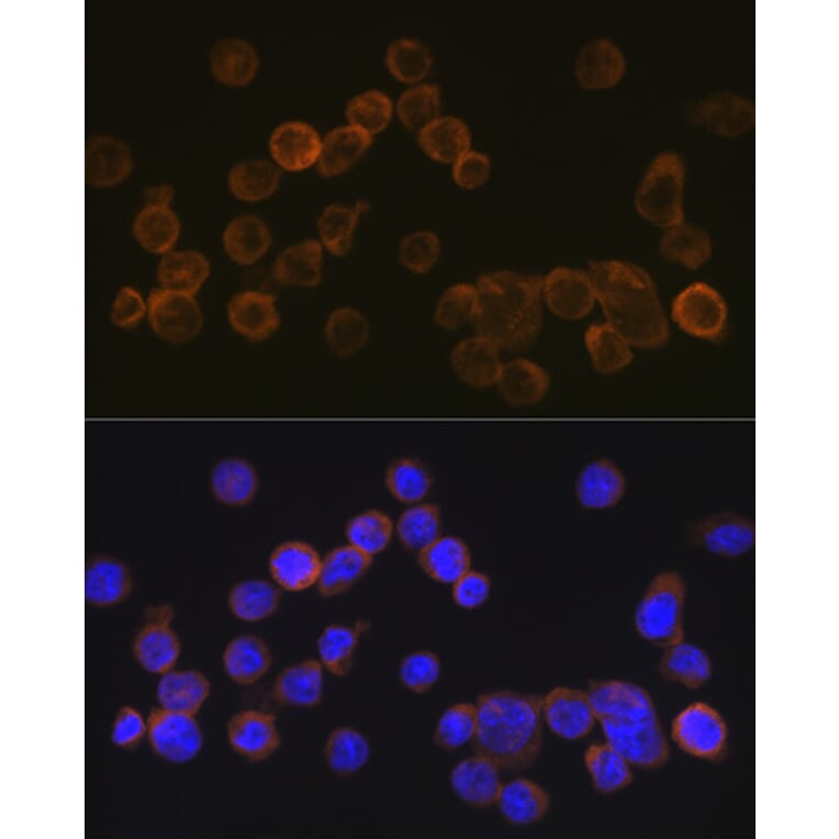 Immunofluorescence - Anti-CD35 Antibody [ARC2065] (A305576) - Antibodies.com