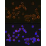 Immunofluorescence - Anti-CD35 Antibody [ARC2065] (A305576) - Antibodies.com