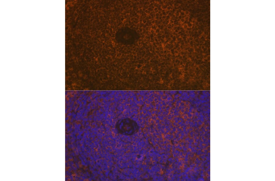 Immunofluorescence - Anti-CD35 Antibody [ARC2065] (A305576) - Antibodies.com