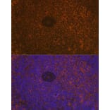 Immunofluorescence - Anti-CD35 Antibody [ARC2065] (A305576) - Antibodies.com