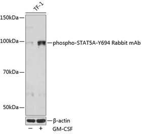 Western Blot - Anti-STAT5 (phospho Tyr694) Antibody [ARC0176] (A305577) - Antibodies.com