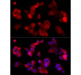 Immunofluorescence - Anti-ABCA1 Antibody [ARC54239] (A305579) - Antibodies.com