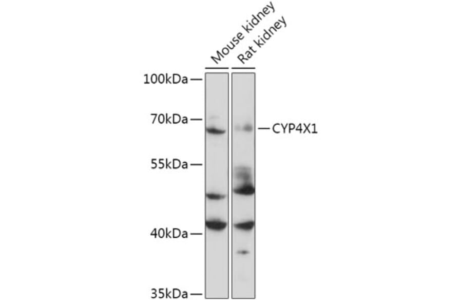 Western Blot - Anti-CYP4X1 Antibody (A305580) - Antibodies.com