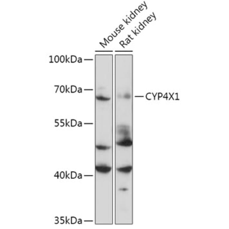 Western Blot - Anti-CYP4X1 Antibody (A305580) - Antibodies.com
