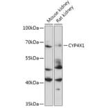 Western Blot - Anti-CYP4X1 Antibody (A305580) - Antibodies.com