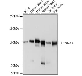 Western Blot - Anti-CTNNA3 Antibody [ARC2463] (A305581) - Antibodies.com