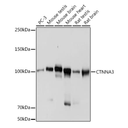 Western Blot - Anti-CTNNA3 Antibody [ARC2463] (A305581) - Antibodies.com