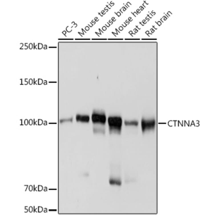 Western Blot - Anti-CTNNA3 Antibody [ARC2463] (A305581) - Antibodies.com