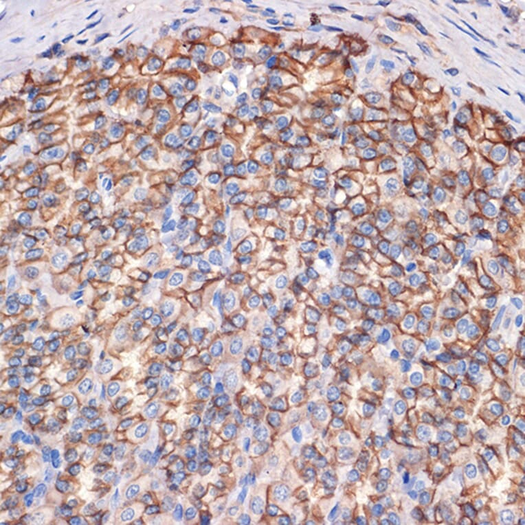 Immunohistochemistry - Anti-CTNNA3 Antibody [ARC2463] (A305581) - Antibodies.com