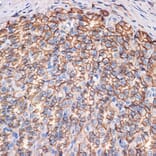 Immunohistochemistry - Anti-CTNNA3 Antibody [ARC2463] (A305581) - Antibodies.com