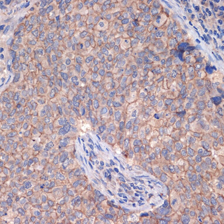 Immunohistochemistry - Anti-CTNNA3 Antibody [ARC2463] (A305581) - Antibodies.com