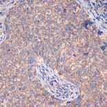 Immunohistochemistry - Anti-CTNNA3 Antibody [ARC2463] (A305581) - Antibodies.com