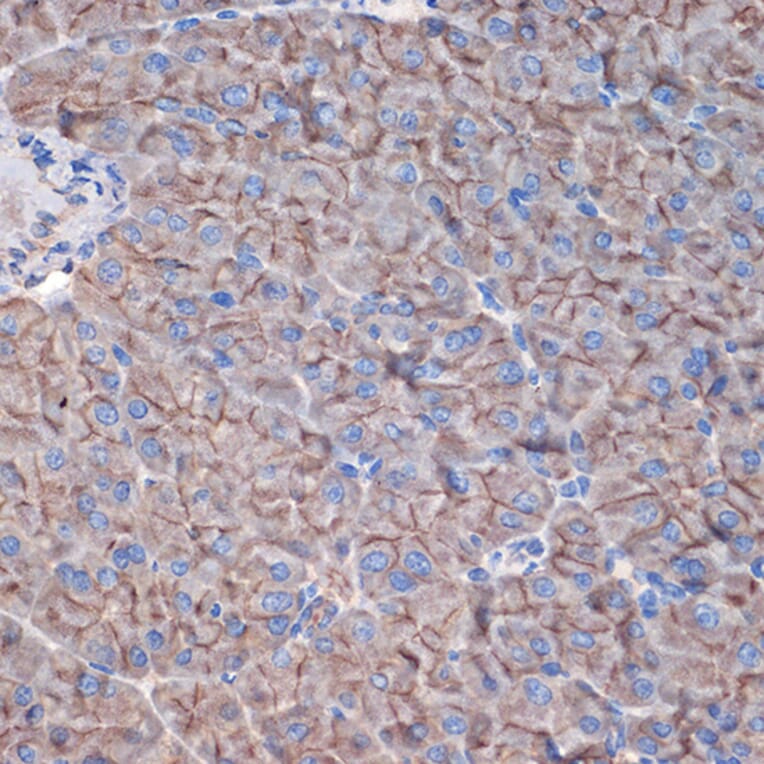 Immunohistochemistry - Anti-CTNNA3 Antibody [ARC2463] (A305581) - Antibodies.com