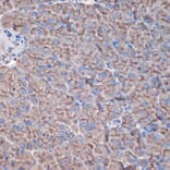 Immunohistochemistry - Anti-CTNNA3 Antibody [ARC2463] (A305581) - Antibodies.com