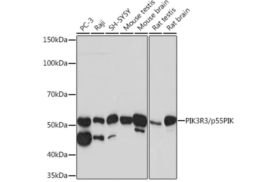 Western Blot - Anti-PI 3 Kinase p55 gamma Antibody [ARC0320] (A305582) - Antibodies.com