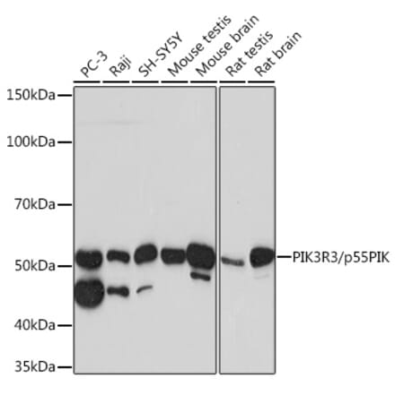 Western Blot - Anti-PI 3 Kinase p55 gamma Antibody [ARC0320] (A305582) - Antibodies.com