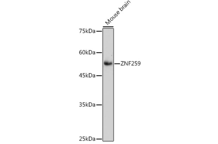 Western Blot - Anti-ZPR1 Antibody [ARC2563] (A305583) - Antibodies.com