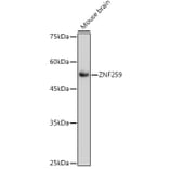 Western Blot - Anti-ZPR1 Antibody [ARC2563] (A305583) - Antibodies.com