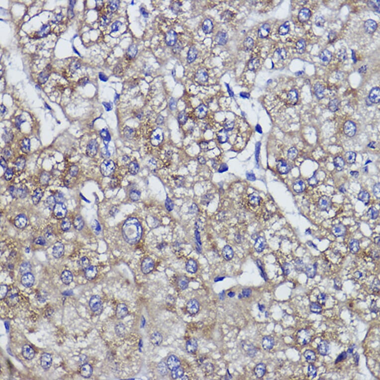 Immunohistochemistry - Anti-ZPR1 Antibody [ARC2563] (A305583) - Antibodies.com