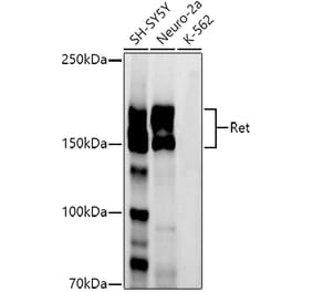 Western Blot - Anti-Ret Antibody [ARC51764] (A305584) - Antibodies.com