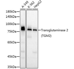 Western Blot - Anti-Transglutaminase 2 Antibody [ARC52843] (A305585) - Antibodies.com