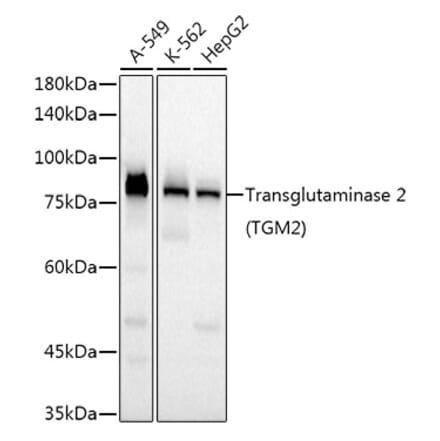 Western Blot - Anti-Transglutaminase 2 Antibody [ARC52843] (A305585) - Antibodies.com