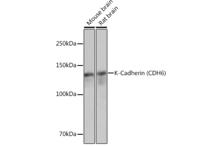 Western Blot - Anti-K Cadherin/CDH6 Antibody [ARC1093] (A305586) - Antibodies.com