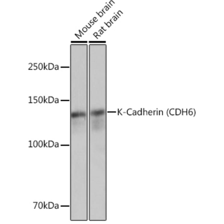 Western Blot - Anti-K Cadherin/CDH6 Antibody [ARC1093] (A305586) - Antibodies.com