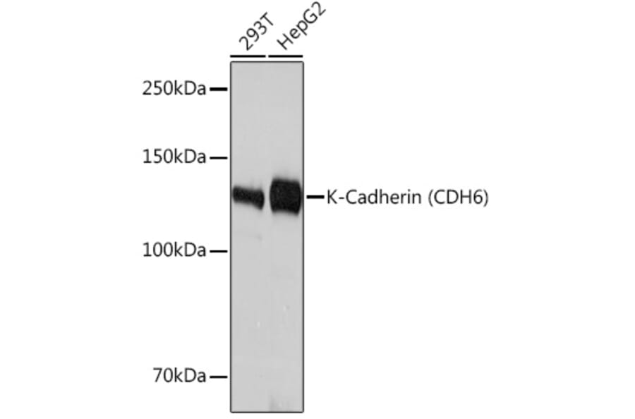 Western Blot - Anti-K Cadherin/CDH6 Antibody [ARC1093] (A305586) - Antibodies.com