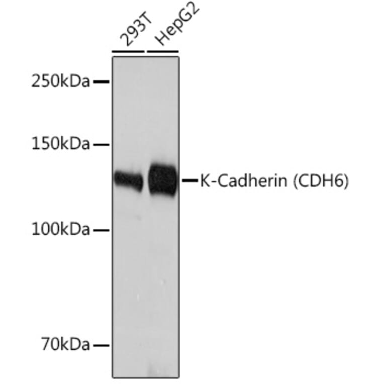 Western Blot - Anti-K Cadherin/CDH6 Antibody [ARC1093] (A305586) - Antibodies.com