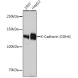 Western Blot - Anti-K Cadherin/CDH6 Antibody [ARC1093] (A305586) - Antibodies.com