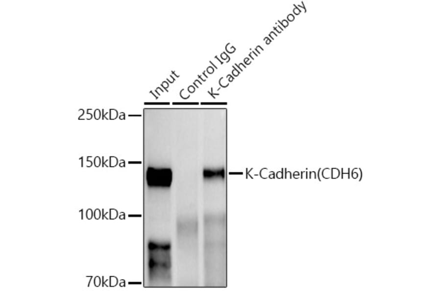 Western Blot - Anti-K Cadherin/CDH6 Antibody [ARC1093] (A305586) - Antibodies.com