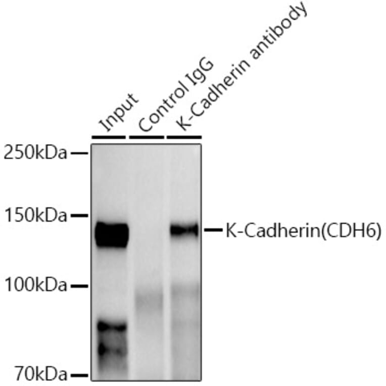 Western Blot - Anti-K Cadherin/CDH6 Antibody [ARC1093] (A305586) - Antibodies.com