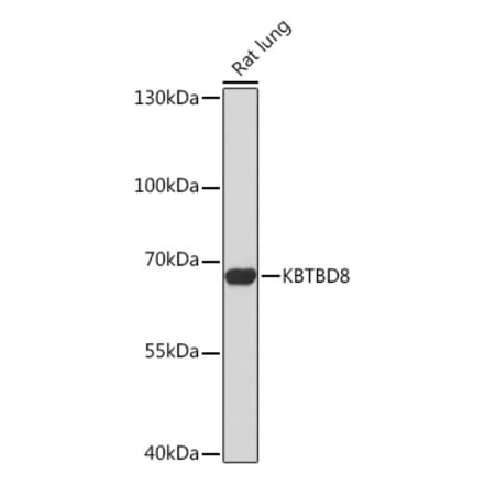 Western Blot - Anti-KBTBD8 Antibody (A305587) - Antibodies.com
