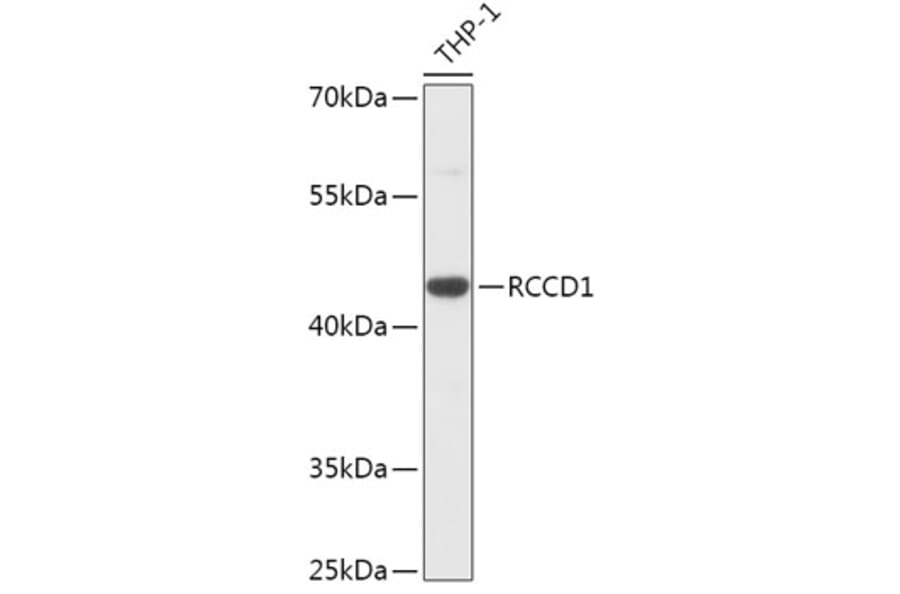 Western Blot - Anti-RCCD1 Antibody (A305589) - Antibodies.com