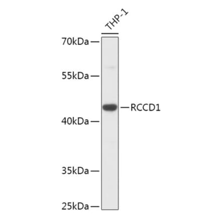 Western Blot - Anti-RCCD1 Antibody (A305589) - Antibodies.com