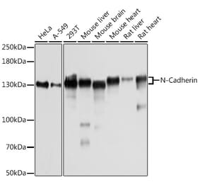 Western Blot - Anti-N Cadherin Antibody (A305590) - Antibodies.com