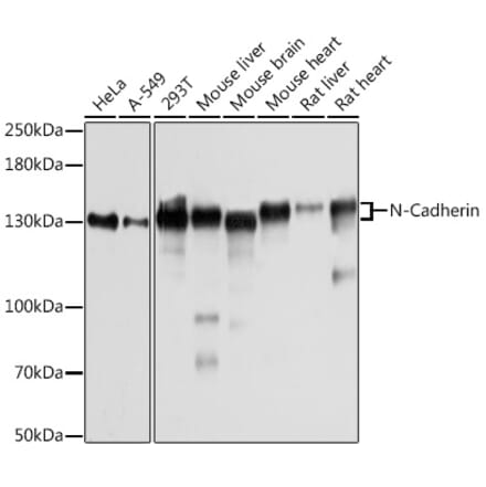 Western Blot - Anti-N Cadherin Antibody (A305590) - Antibodies.com