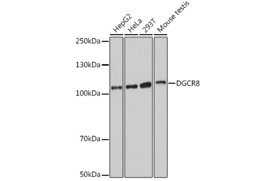Western Blot - Anti-DGCR8 Antibody (A305592) - Antibodies.com