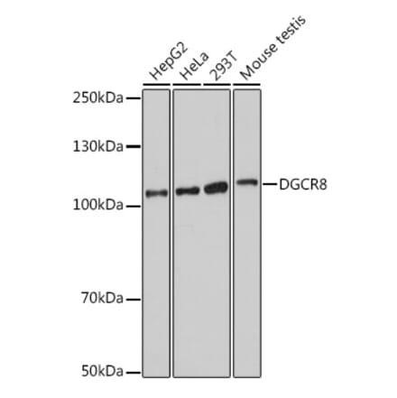 Western Blot - Anti-DGCR8 Antibody (A305592) - Antibodies.com