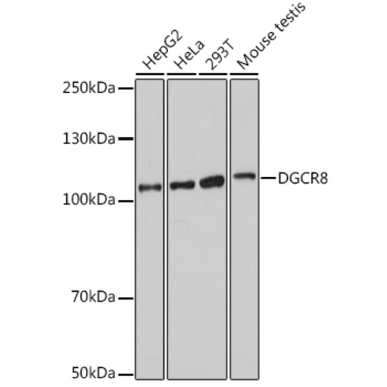 Western Blot - Anti-DGCR8 Antibody (A305592) - Antibodies.com