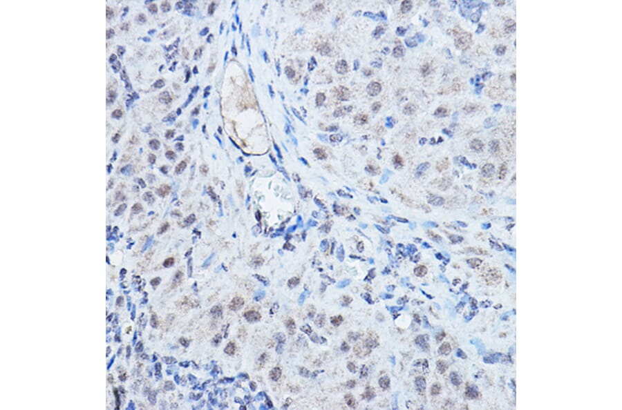 Immunohistochemistry - Anti-DGCR8 Antibody (A305592) - Antibodies.com