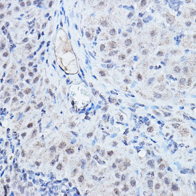 Immunohistochemistry - Anti-DGCR8 Antibody (A305592) - Antibodies.com