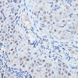 Immunohistochemistry - Anti-DGCR8 Antibody (A305592) - Antibodies.com