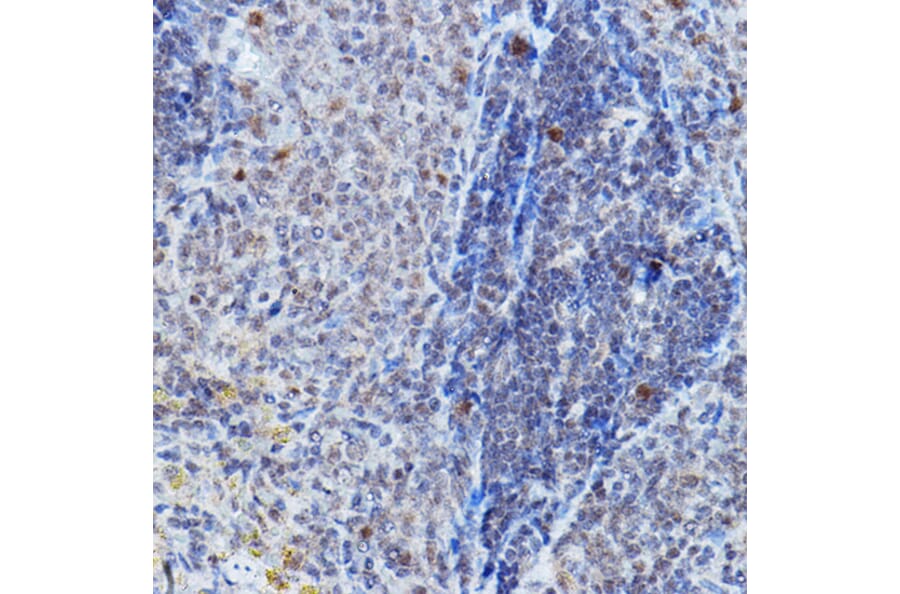 Immunohistochemistry - Anti-DGCR8 Antibody (A305592) - Antibodies.com