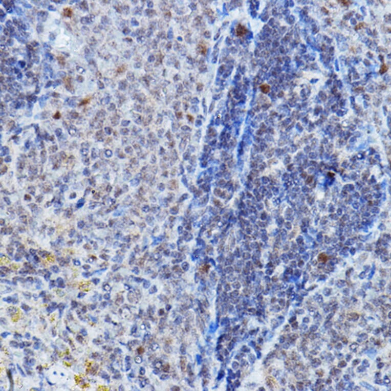 Immunohistochemistry - Anti-DGCR8 Antibody (A305592) - Antibodies.com